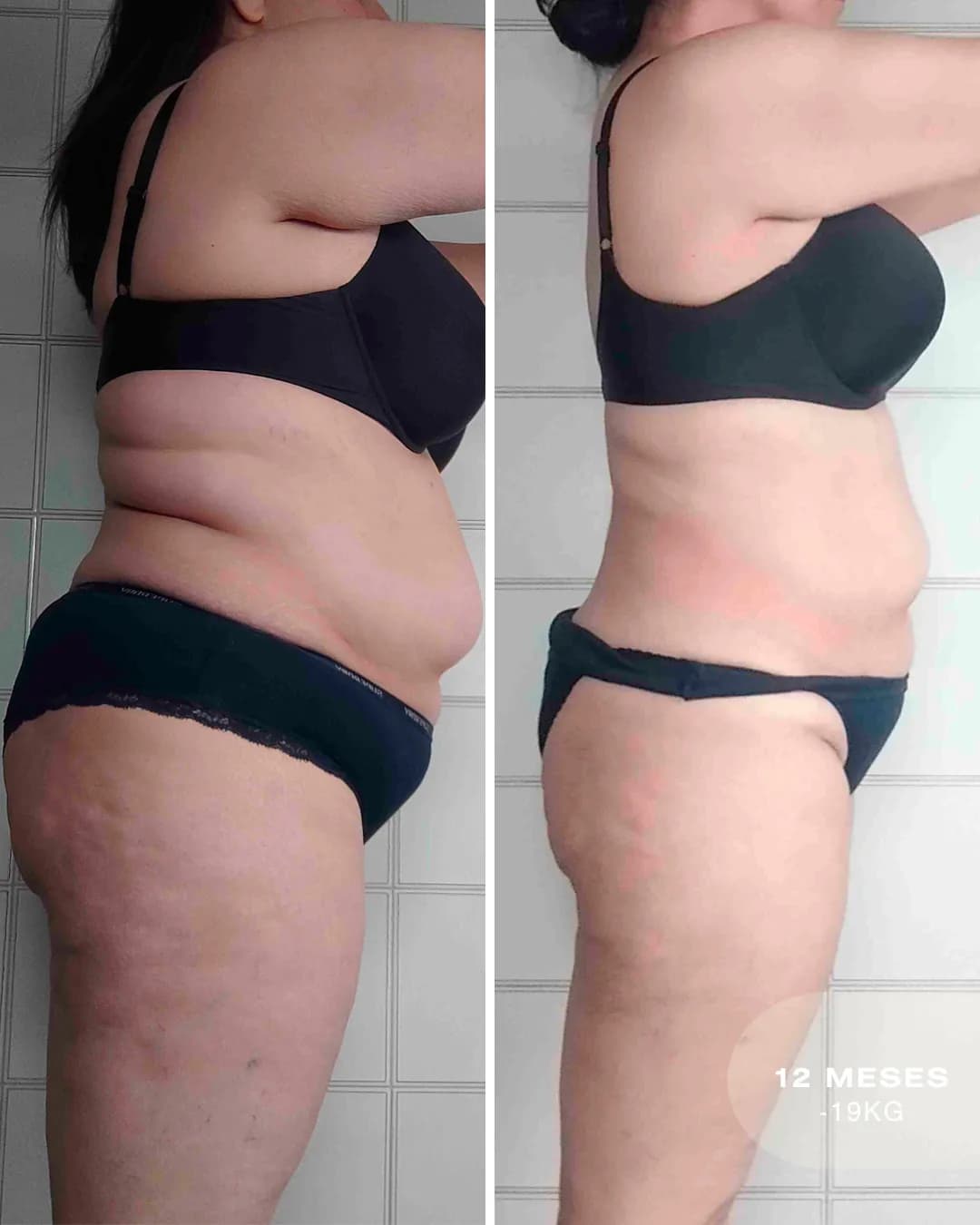 Antes y después de Rebeca: -19 kg en 12 meses